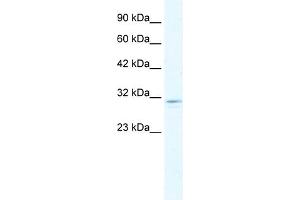 WB Suggested Anti-CLIC2 Antibody Titration:  1. (CLIC2 antibody  (C-Term))