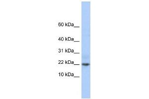 Western Blotting (WB) image for anti-Chromosome 9 Open Reading Frame 25 (C9orf25) antibody (ABIN2459916) (C9orf25 antibody)