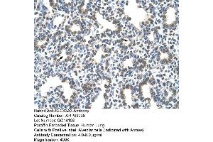 Human Lung (SLC43A3 antibody  (N-Term))