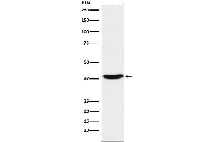 Western blot analysis of MT-ND1 expression in Human fetal muscle lysate.