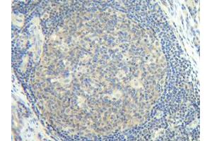 Image no. 3 for anti-Interleukin 2 (IL2) antibody (ABIN181648) (IL-2 antibody)