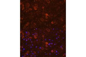 Immunofluorescence analysis of NIH/3T3 cells using FGF17 Rabbit pAb (ABIN7267183) at dilution of 1:150 (40x lens). (FGF17 antibody  (AA 23-180))