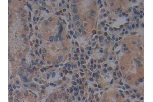 Immunohistochemistry (IHC) image for anti-Toll-Like Receptor 9 (TLR9) (AA 28-362) antibody (ABIN7432445)