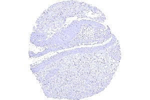 Amnion and chorion cells of the placenta lack KISS1 staining
