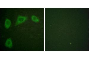 Immunofluorescence analysis of HuvEc cells, using Caveolin-1 antibody. (Caveolin-1 antibody)