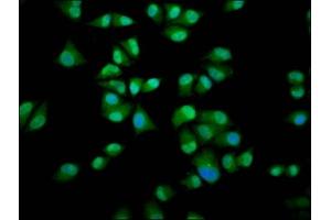 Immunofluorescence staining of Hela cells with ABIN7156289 at 1:200, counter-stained with DAPI. (IMPDH1 antibody  (AA 191-281))