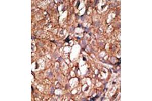 Image no. 2 for anti-5'-Nucleotidase, Ecto (CD73) (NT5E) (C-Term) antibody (ABIN357390) (CD73 antibody  (C-Term))