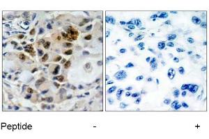Image no. 1 for anti-Forkhead Box O4 (FOXO4) (Ser197) antibody (ABIN197368) (FOXO4 antibody  (Ser197))