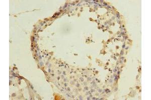 Immunohistochemistry of paraffin-embedded human testis tissue using ABIN7143124 at dilution of 1:100 (ARPM1 antibody  (AA 1-372))