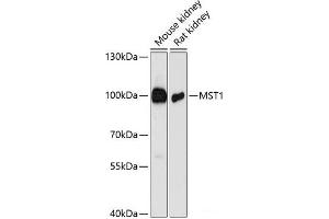 Western blot analysis of extracts of various cell lines using MST1 Polyclonal Antibody at dilution of 1:3000. (MST1 antibody)