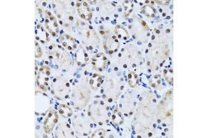 Immunohistochemistry of paraffin-embedded rat kidney using CCAR2 antibody (ABIN2563550) at dilution of 1:100 (40x lens). (CCAR2 antibody)