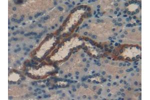 DAB staining on IHC-P; Samples: Human Kidney Tissue (RBP1 antibody  (AA 2-135))