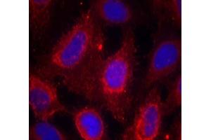 Immunofluorescence staining of methanol-fixed HeLa cells using TrkA (Ab-791) Antibody (E021326, Red) (TRKA antibody)