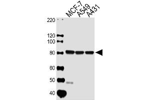 Lane 1: MCF-7 Cell lysates, Lane 2: A549 Cell lysates, Lane 3: A431 Cell lysates, probed with CAPN1 (1376CT809.