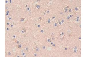 Immunohistochemistry (IHC) image for anti-Hexosaminidase B (Beta Polypeptide) (HEXB) (AA 122-311) antibody (ABIN7438553)
