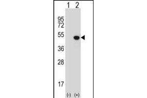 Western blot analysis of JMJD5 (arrow) using rabbit polyclonal JMJD5 Antibody (N-term) (ABIN654939 and ABIN2844581). (JMJD5 antibody  (N-Term))