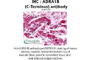 Image no. 1 for anti-Adrenergic, alpha-1B-, Receptor (ADRA1B) (C-Term) antibody (ABIN1731574)