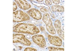 Immunohistochemistry of paraffin-embedded rat kidney using RPL4 Rabbit pAb (ABIN6129106, ABIN6147145, ABIN6147146 and ABIN6221591) at dilution of 1:100 (40x lens). (RPL4 antibody  (AA 1-240))