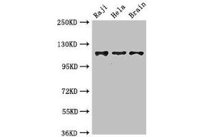 Western Blot Positive WB detected in: Raji whole cell lysate, Hela whole cell lysate, Mouse brain tissue All lanes: KIF11 antibody at 3. (KIF11 antibody  (AA 920-1038))