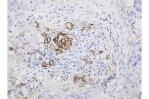 Image no. 1 for anti-Parathyroid Hormone (PTH) (AA 32-115) antibody (ABIN1491410) (PTH antibody  (AA 32-115))