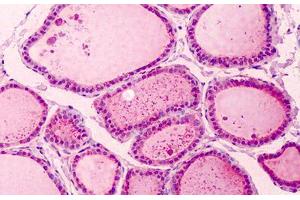 Human Thyroid: Formalin-Fixed, Paraffin-Embedded (FFPE) (PAK2 antibody  (C-Term))