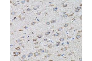 Immunohistochemistry of paraffin-embedded Rat brain using PSMD10 Polyclonal Antibody at dilution of 1:100 (40x lens). (PSMD10 antibody)