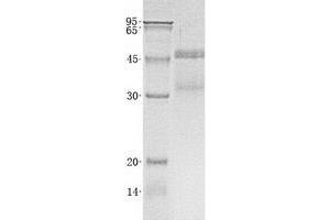 Validation with Western Blot (VEGFC Protein (His tag))