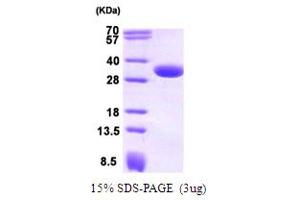 SDS-PAGE (SDS) image for Carbonyl Reductase 1 (CBR1) (AA 1-277) protein (ABIN667101) (CBR1 Protein (AA 1-277))