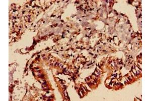 Immunocytochemistry analysis of human lung tissue using ABIN7163177 at dilution of 1:100 (PREX1 antibody  (AA 1-44))
