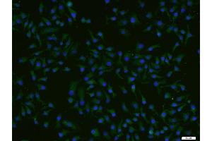 HepG2 cells were stained with ADCK4 Polyclonal Antibody, Unconjugated (bs-8070R) at 1:200 and incubated for 90 minutesat room temperature, followed by secondary antibody incubation, DAPI staining of the nuclei and detection.