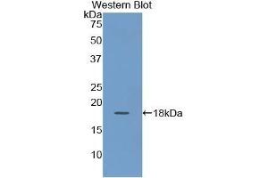 Detection of Recombinant KRT19, Human using Polyclonal Antibody to Cytokeratin 19 (CK19) (Cytokeratin 19 antibody  (AA 245-391))