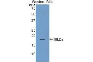 Detection of Recombinant KRT19, Human using Polyclonal Antibody to Cytokeratin 19 (CK19) (Cytokeratin 19 antibody  (AA 245-391))