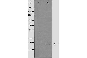 Western blot analysis of extracts of mouse liver, using CAMP antibody. (Cathelicidin antibody  (Internal Region))