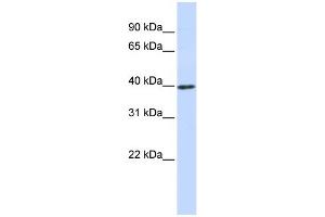 WB Suggested Anti-CCND1 Antibody Titration: 0. (Cyclin D1 antibody  (Middle Region))