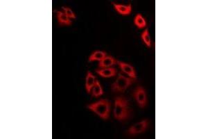 Immunofluorescent analysis of ATG13 staining in A549 cells. (ATG13 antibody)