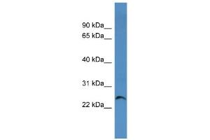 WB Suggested Anti-Cacng1 Antibody Titration:  0. (CACNG1 antibody  (Middle Region))