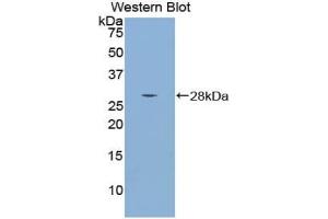 Detection of Recombinant Smad4, Mouse using Polyclonal Antibody to Mothers Against Decapentaplegic Homolog 4 (Smad4) (SMAD4 antibody  (AA 9-231))