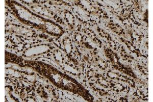 ABIN6279801 at 1/100 staining Human kidney tissue by IHC-P. (ULK2 antibody  (Internal Region))