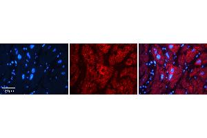 Rabbit Anti-AK1 Antibody   Formalin Fixed Paraffin Embedded Tissue: Human heart Tissue Observed Staining: Cytoplasmic Primary Antibody Concentration: N/A Other Working Concentrations: 1:600 Secondary Antibody: Donkey anti-Rabbit-Cy3 Secondary Antibody Concentration: 1:200 Magnification: 20X Exposure Time: 0.