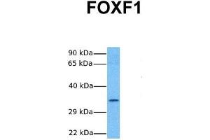 Host:  Rabbit  Target Name:  FOXF1  Sample Tissue:  Human Hela  Antibody Dilution:  1. (FOXF1 antibody  (C-Term))