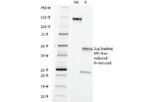 SDS-PAGE Analysis Purified TAG-72 Mouse Monoclonal Antibody (B72. (TAG-72 / CA72.4 antibody)