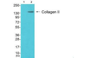 Western Blotting (WB) image for anti-Collagen, Type II (COL2) (N-Term) antibody (ABIN1848474) (COL2 antibody  (N-Term))