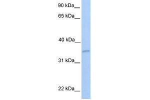 WB Suggested Anti-NKIRAS2 Antibody Titration: 0. (NKIRAS2 antibody  (Middle Region))