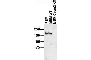 Immunoblot on adult rat brain membrane (RBM), and adult mouse brain membranes (MBM) from wild-type (WT) and Caspr2 knockout mice. (CNTNAP2 antibody  (Extracellular))