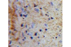 Used in DAB staining on fromalin fixed paraffin-embedded Brain tissue (Peptide YY antibody  (AA 31-97))