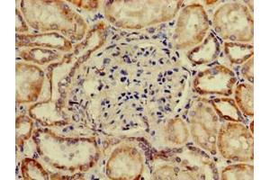 Immunohistochemistry of paraffin-embedded human kidney tissue using ABIN7170416 at dilution of 1:100 (SP11 (AA 137-386) antibody)