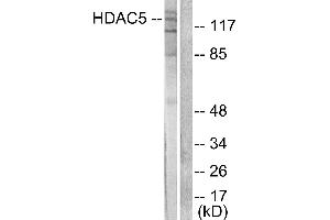 Western blot analysis of extracts from HepG2 cells, treated with PMA (125ng/ml, 30mins), using HDAC5 antibody (#C0225). (HDAC5 antibody)