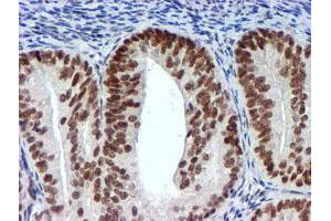 Image no. 7 for anti-Ubiquitin Specific Peptidase 7 (Herpes Virus-Associated) (USP7) antibody (ABIN1498592) (USP7 antibody)