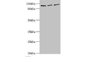 Western blot All lanes: MERTK antibody at 8 μg/mL Lane 1: Mouse gonad tissue Lane 2: Mouse lung tissue Lane 3: Mouse kidney tissue Secondary Goat polyclonal to rabbit IgG at 1/10000 dilution Predicted band size: 110 kDa Observed band size: 110 kDa (MERTK antibody  (AA 840-999))