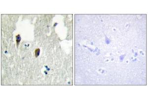 Immunohistochemistry analysis of paraffin-embedded human brain tissue, using KLHL3 antibody. (KLHL3 antibody  (N-Term))